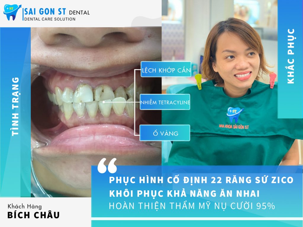 Nha khoa Sài Gòn ST