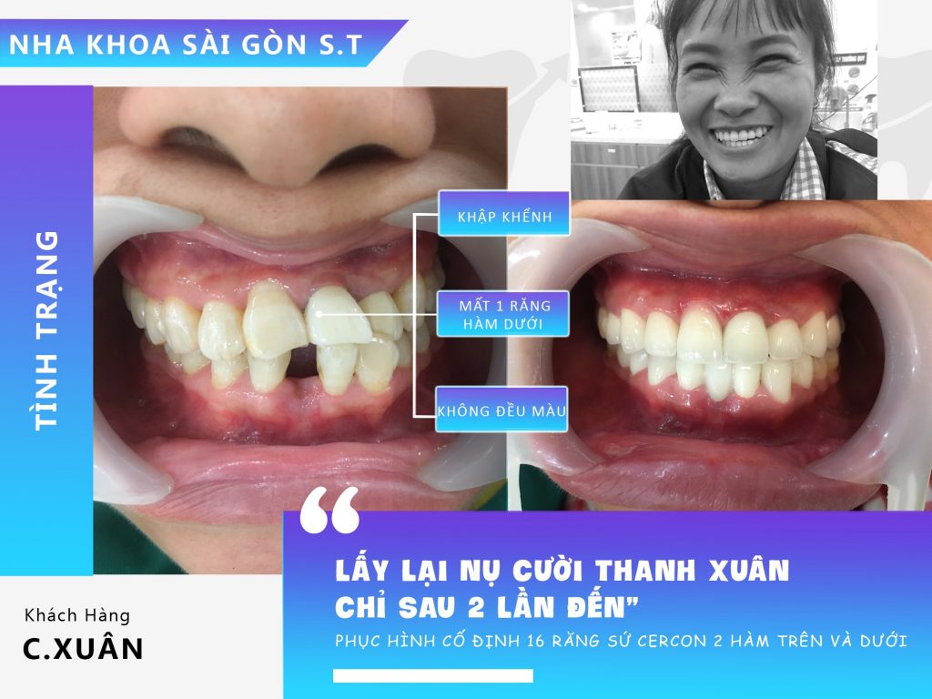 Nha khoa Sài Gòn ST