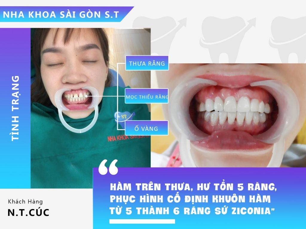 Nha khoa Sài Gòn ST