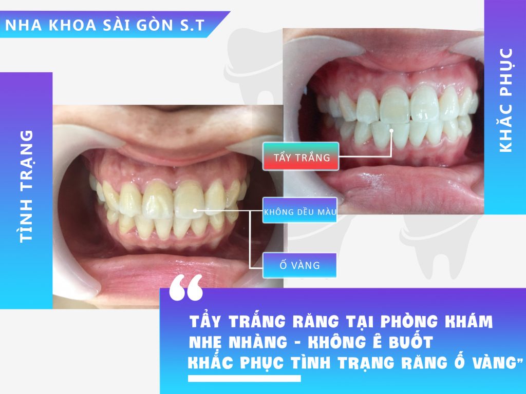 Nha khoa Sài Gòn ST