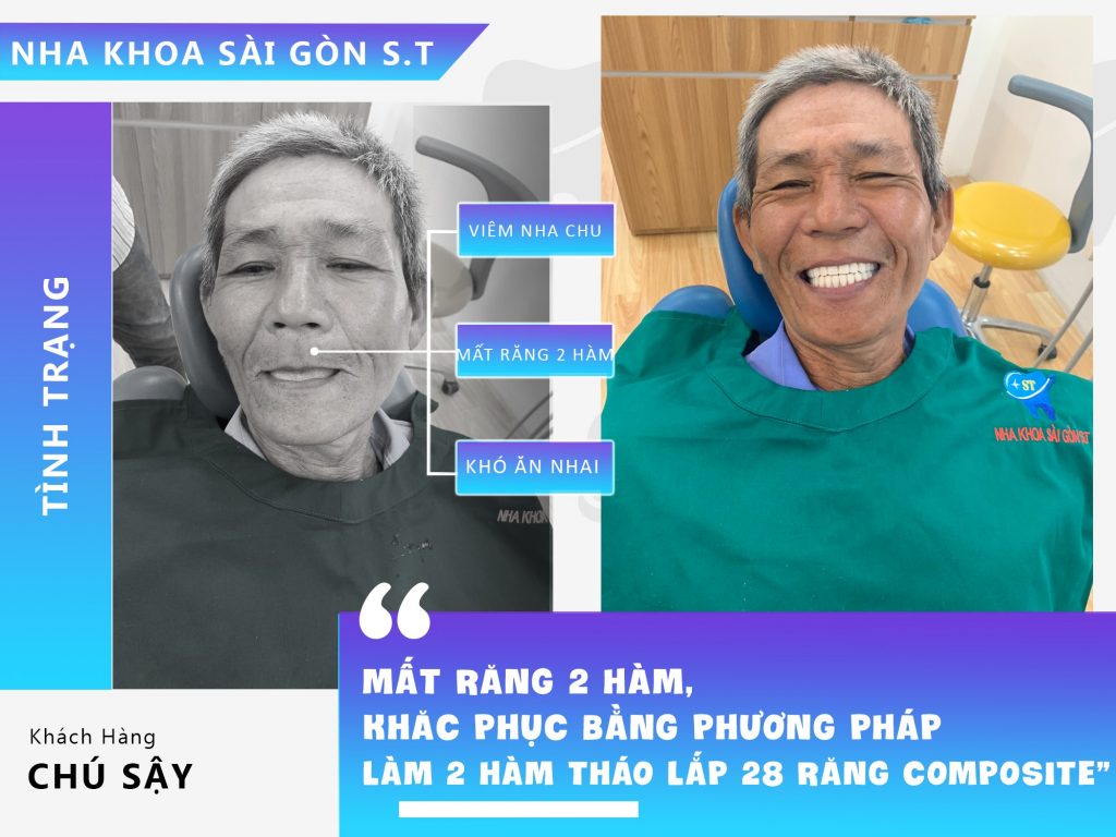 Nha khoa Sài Gòn ST