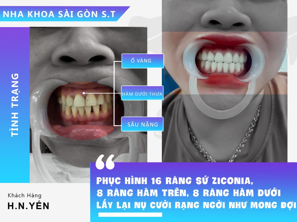 Nha khoa Sài Gòn ST
