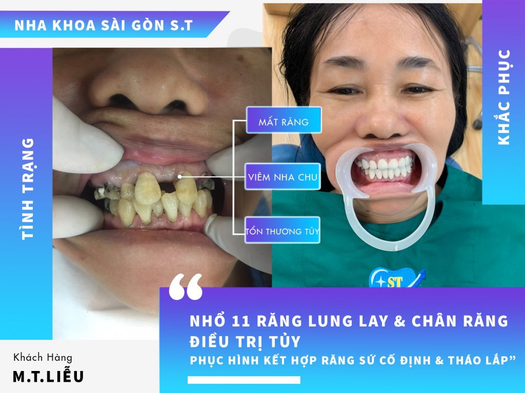 Nha khoa Sài Gòn ST