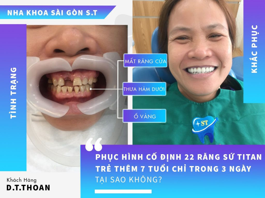 Nha khoa Sài Gòn ST