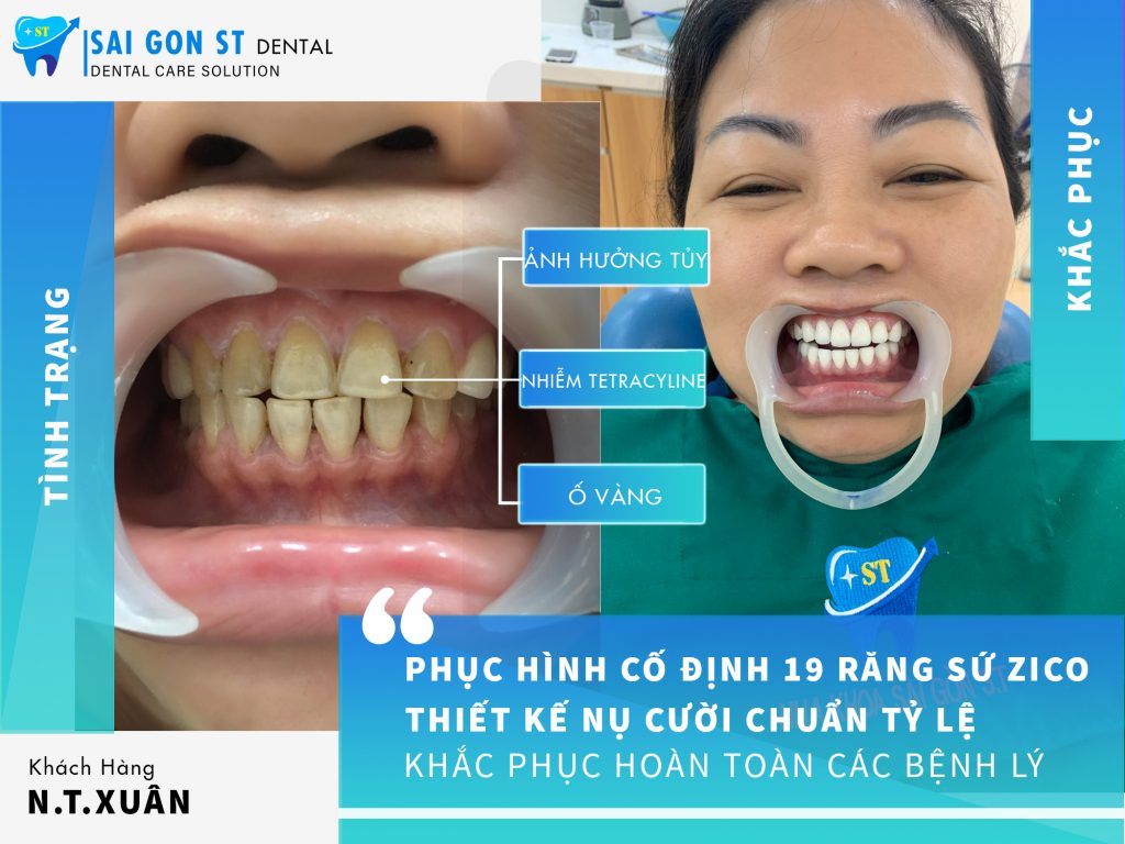 Nha khoa Sài Gòn ST