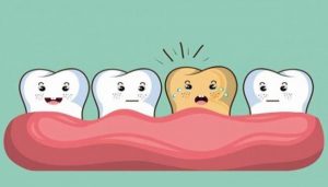 Răng vàng ố là gì? Nguyên nhân làm răng bị vàng ố