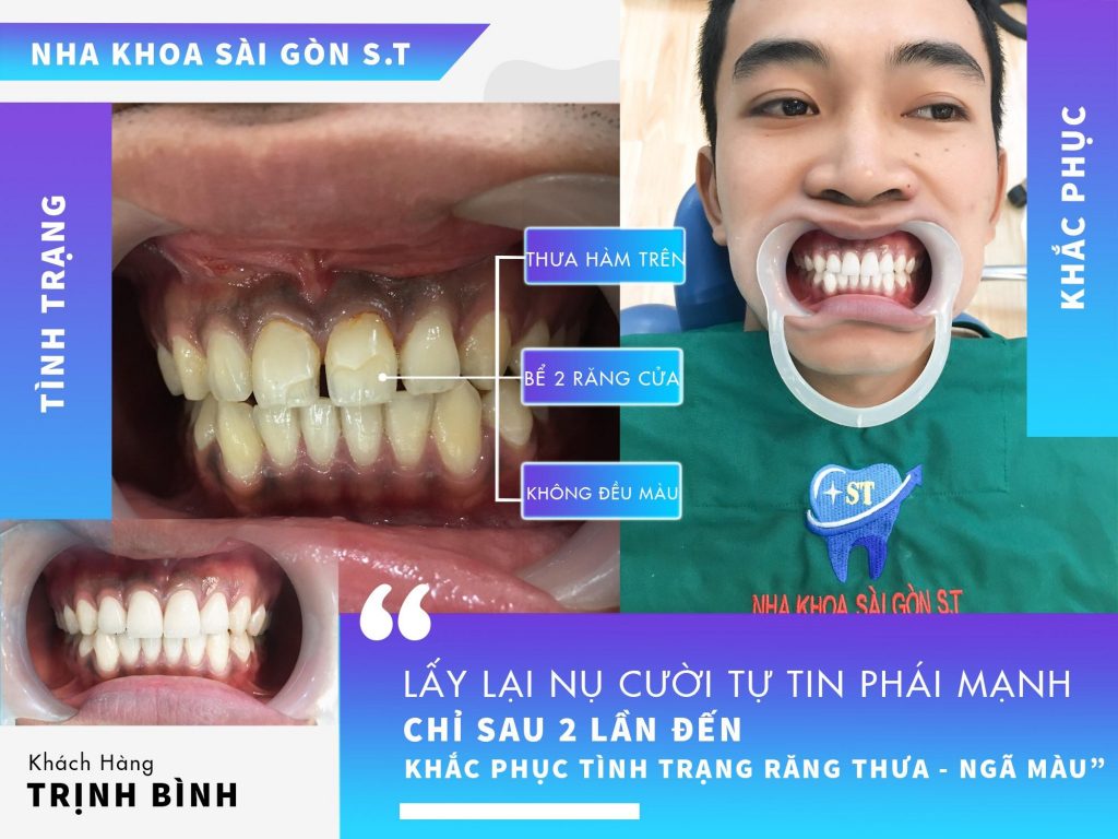Nha khoa Sài Gòn ST
