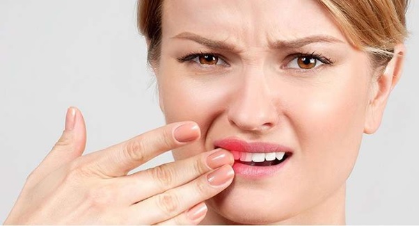 Khi răng bị mẻ vỡ, bạn nên sớm có biện pháp hồi phục 
