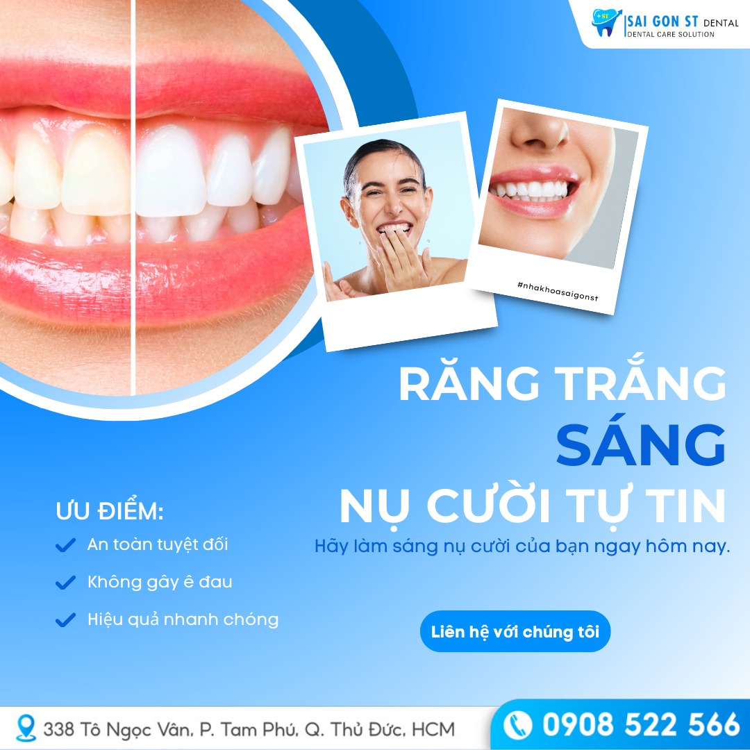 Cách Làm Trắng Răng Ố Vàng Tại Nhà Hiệu Quả