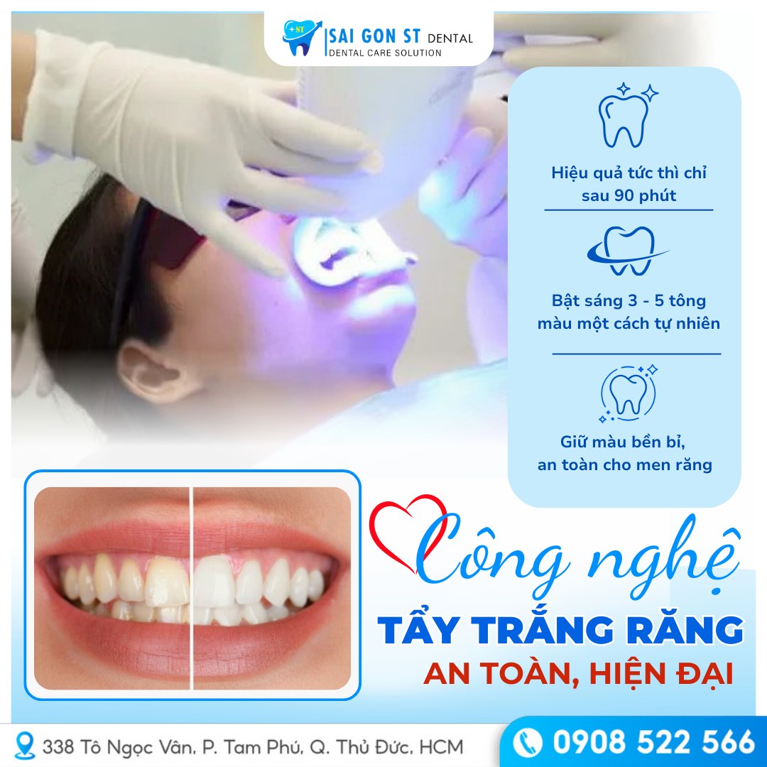 Cách Làm Trắng Răng Ố Vàng Tại Nhà Hiệu Quả
