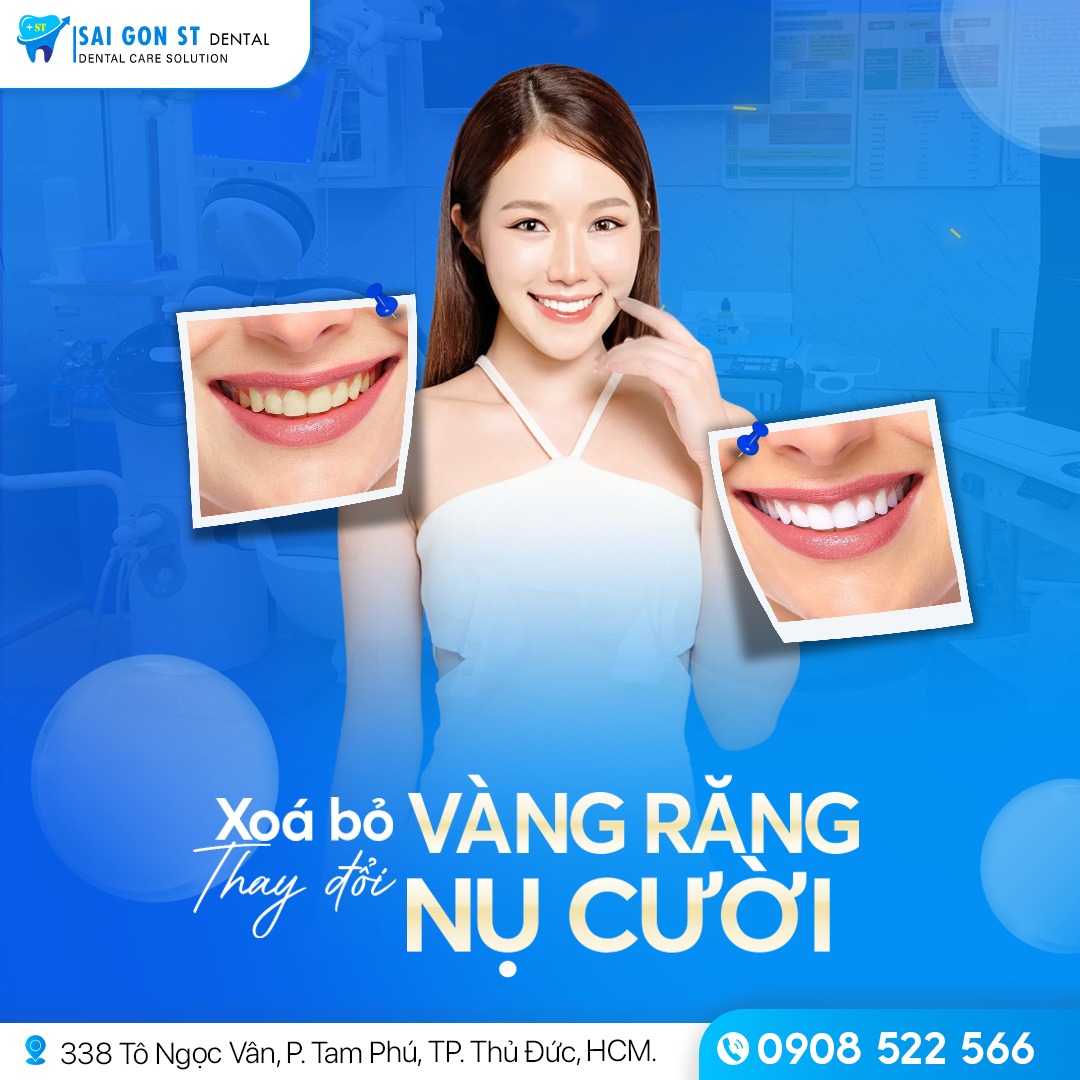 Cách Làm Trắng Răng Ố Vàng Tại Nhà Hiệu Quả