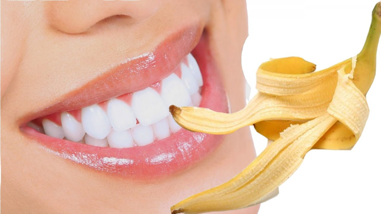 Cách Làm Trắng Răng Ố Vàng Tại Nhà Hiệu Quả