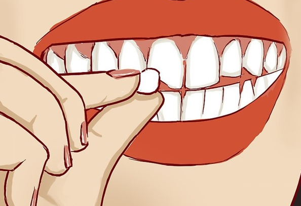 Mẻ răng cửa là gì? Những nguyên nhân và tác hại của mẻ răng cửa?
