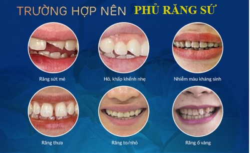 Nha khoa Sài Gòn ST