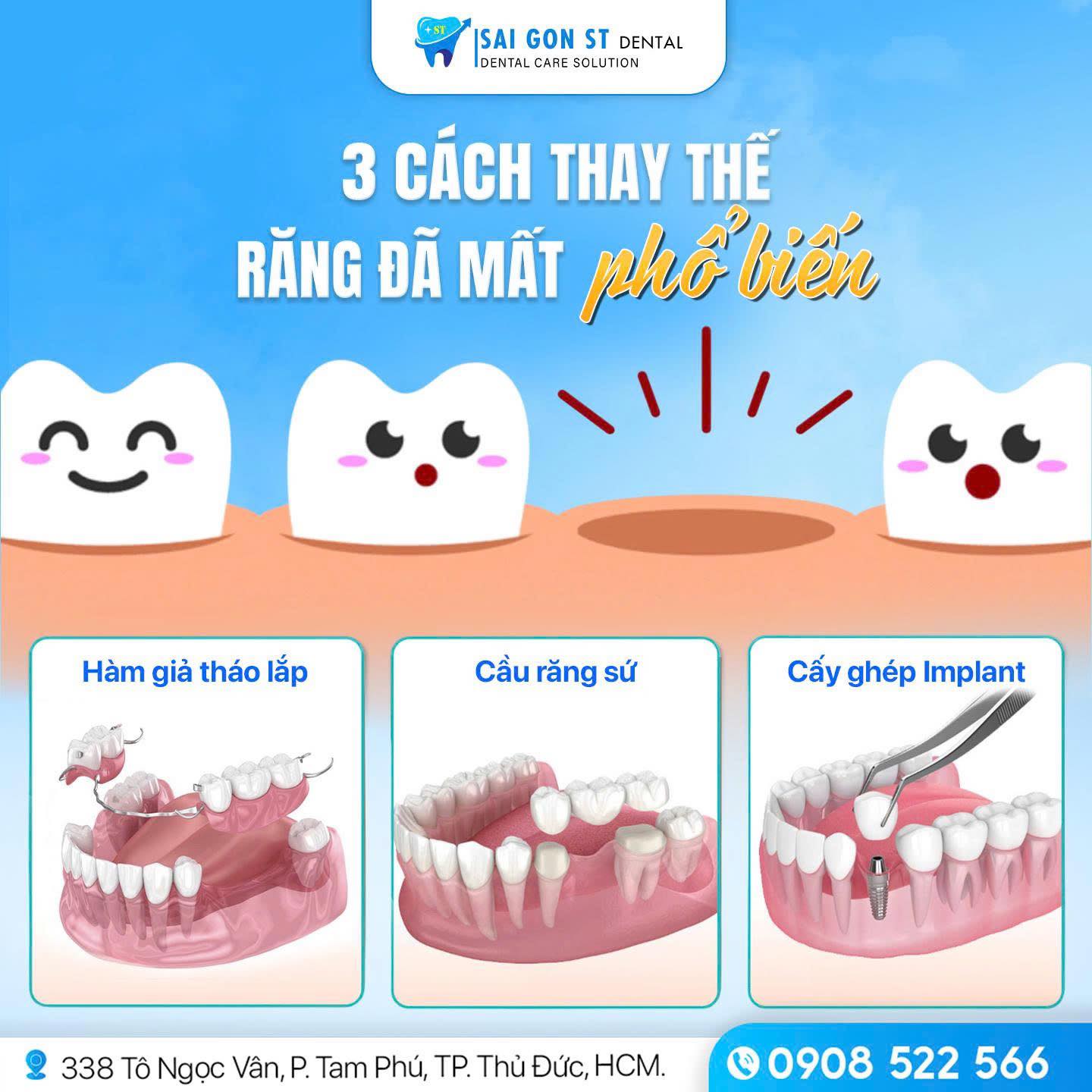 Hậu Quả Khi Mất Răng Số 3 Và Cách Phục Hình Hiệu Quả