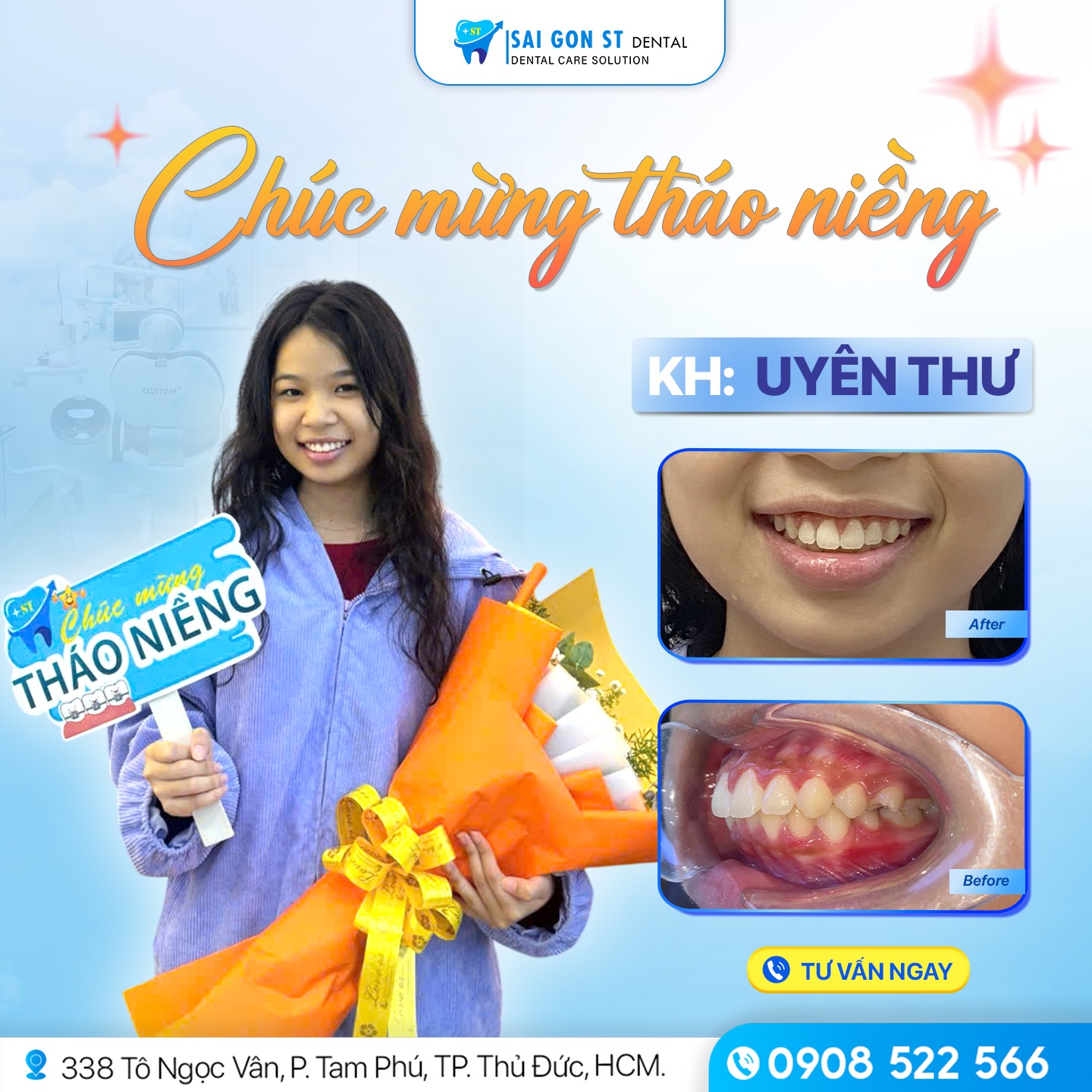 Niềng Răng Hô – Quy Trình Và Phương Pháp Thực Hiện