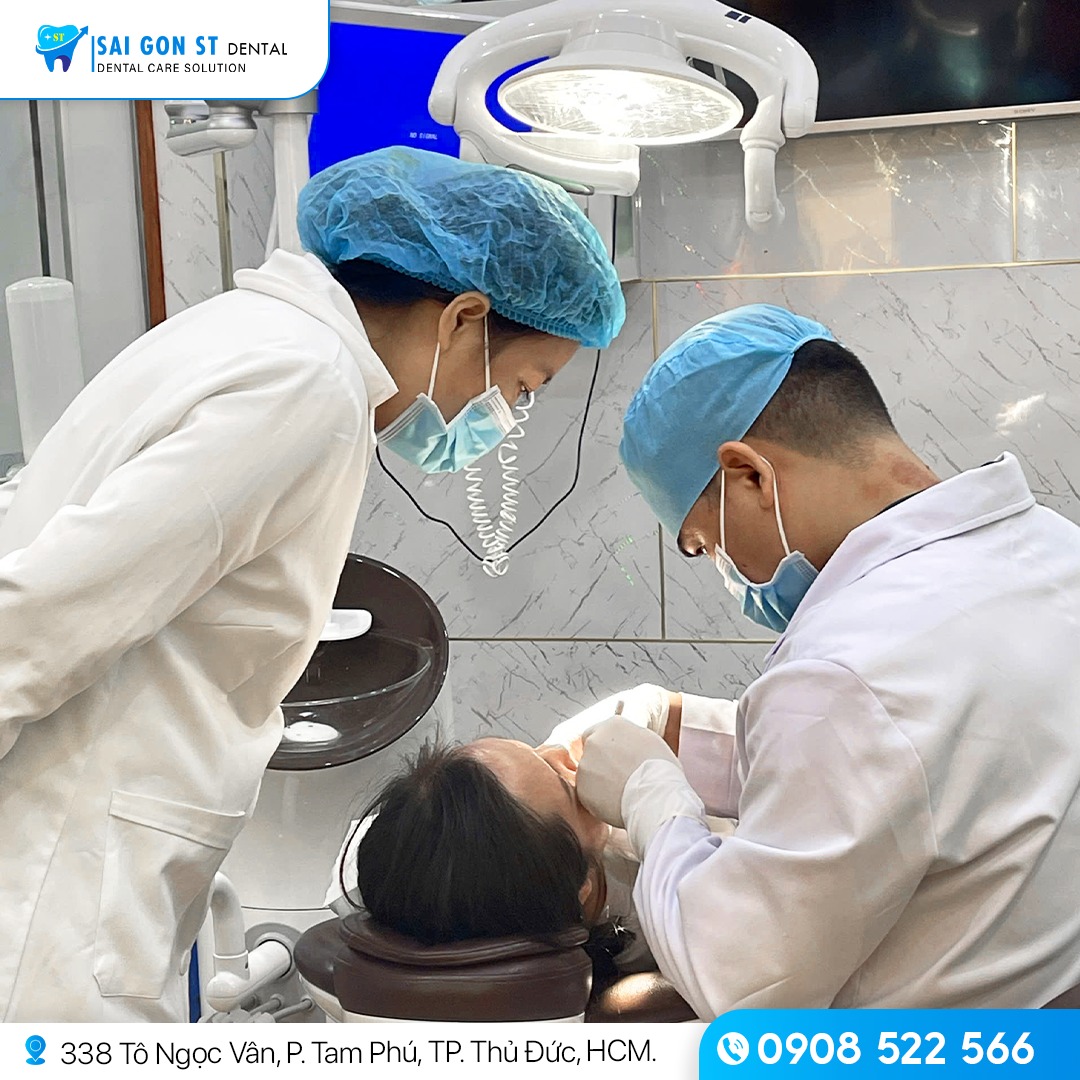 Răng Hàm Bị Sâu Nguyên Nhân, Triệu Chứng Và Cách Điều Trị