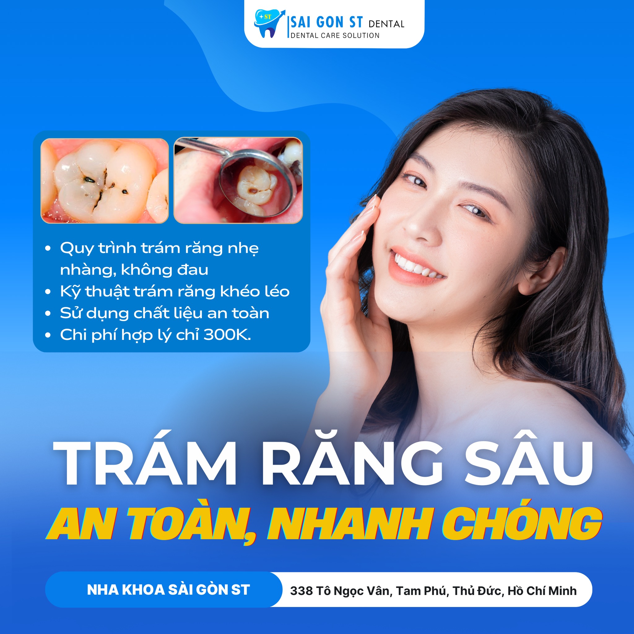 Sâu Răng Là Gì Nguyên Nhân, Triệu Chứng Và Cách Điều Trị (4)