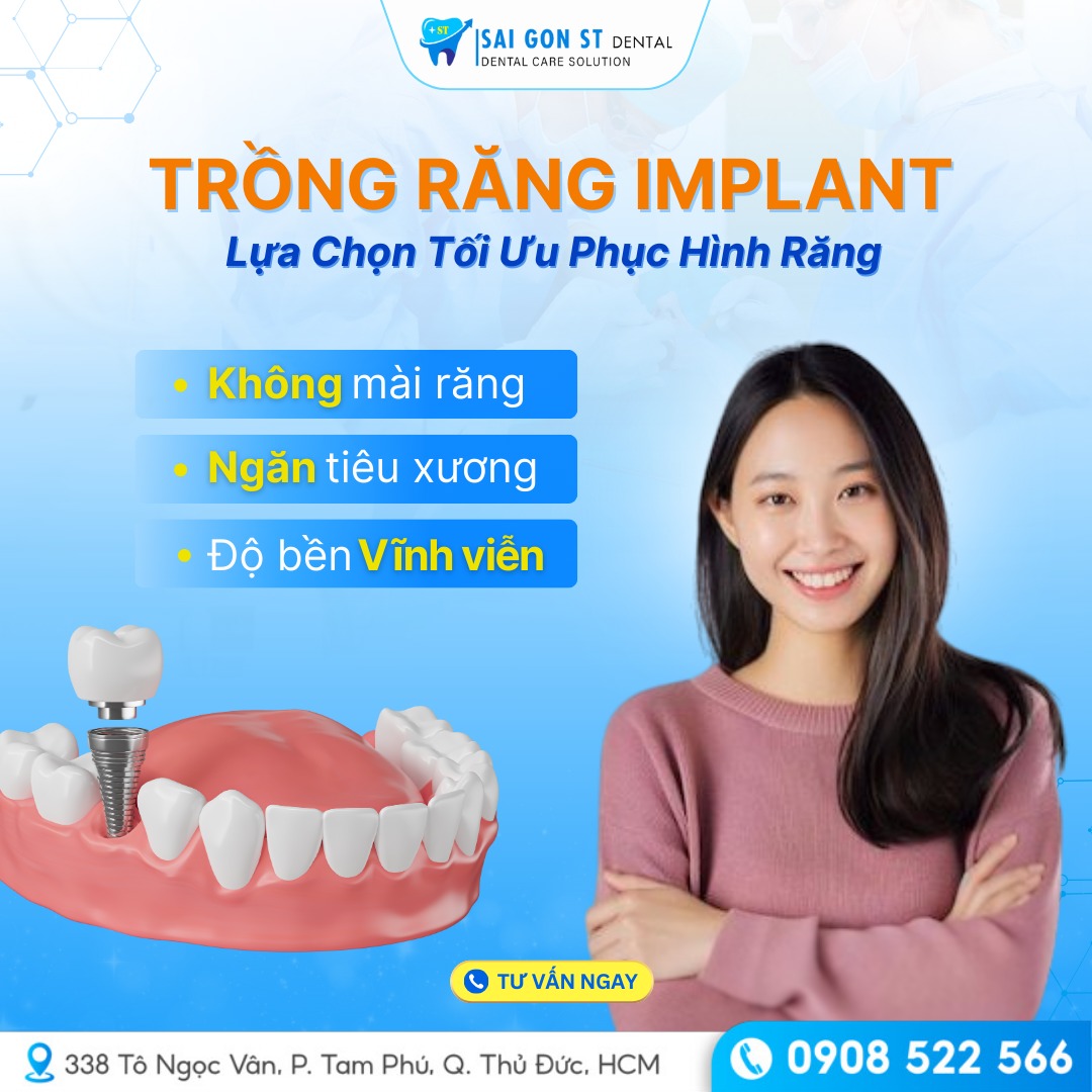 Sâu Răng Là Gì Nguyên Nhân, Triệu Chứng Và Cách Điều Trị (7)