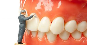 Lấy cao (vôi) răng có hại không? Có ảnh hưởng gì kh
