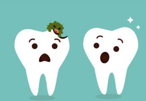 Bị mẻ răng có sao không? Có ảnh hưởng gì không?