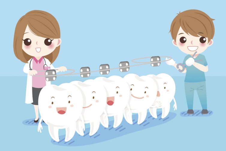 Hô vẩu do răng, là trường hợp nhẹ nhất trong các trường hợp hô