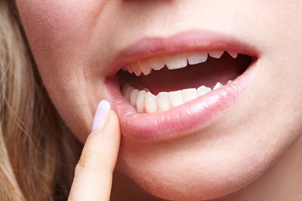 Làm sao để khắc phục tình trạng răng giả lung lay?