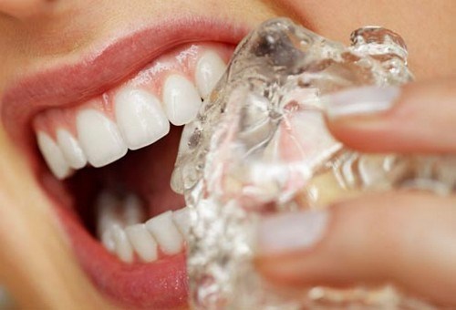 Tránh nhai đồ ăn quá cứng hoặc cắn những vật cứng để tránh trường hợp răng bị mẻ