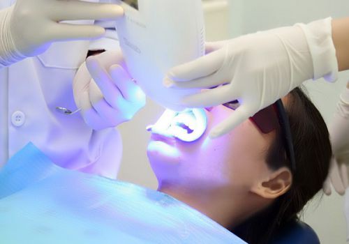 Bạn có thể thực hiện tẩy trắng răng tại phòng khám