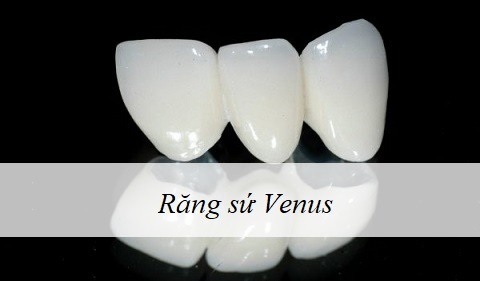 Răng sứ Venus thuộc nhóm răng toàn sứ không kim loại