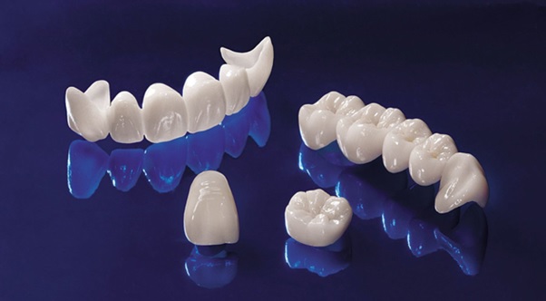 Đối với chất liệu răng sứ tinh thể được ứng dụng trong công nghệ dán răng sứ