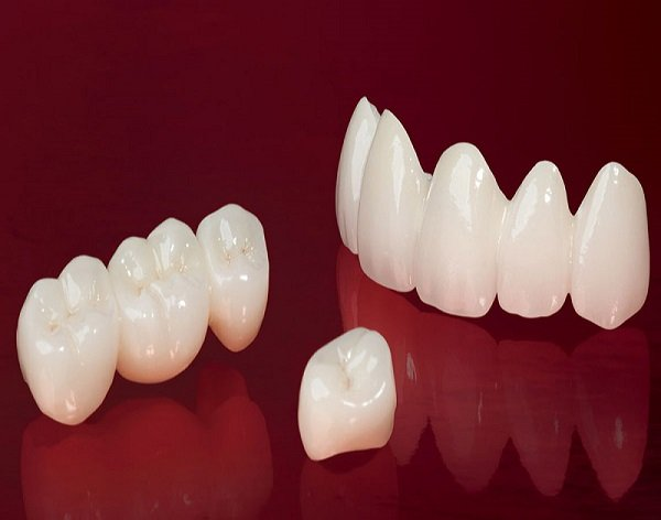 Răng sứ thuỷ tinh là loại răng toàn sứ cao cấp