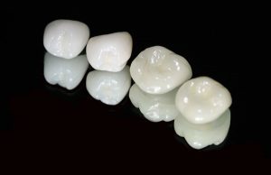Răng sứ Ceramill là gì? Bọc răng sứ Ceramill có tốt không?