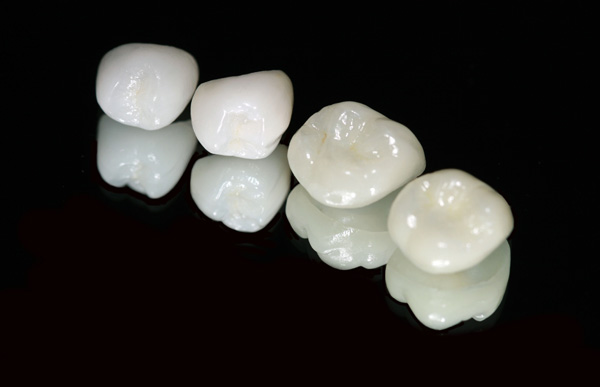 Răng sứ thủy tinh là chất liệu thuộc dòng sứ cao cấp