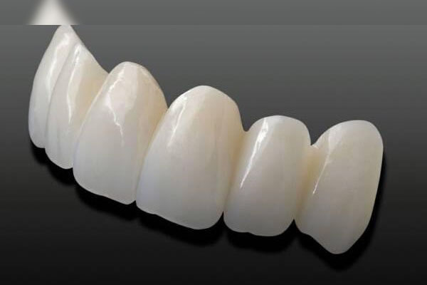 Răng sứ cercon là loại răng toàn sứ được sản xuất và độc quyền bởi Hãng Densply.