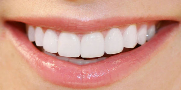 Răng sứ Lumineers có hại không?