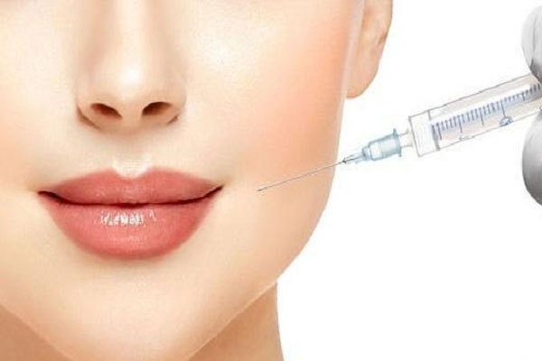Tiêm hoạt chất Filler hoặc Botox để kéo môi lên cao