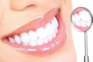 Làm răng sứ có hại không? Những vấn đề quan trọng khi làm răng sứ cần lưu ý