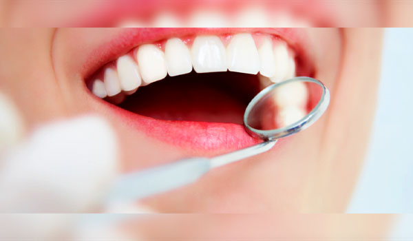 Răng sứ Cercon HT là gì? Bọc răng sứ Cercon HT có tốt không?