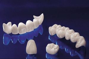 Răng sứ Zirconia là gì? Bọc răng sứ Zirconia có tốt không?
