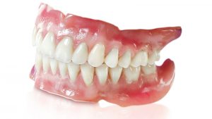 Quy trình trồng răng tháo lắp mất bao lâu?