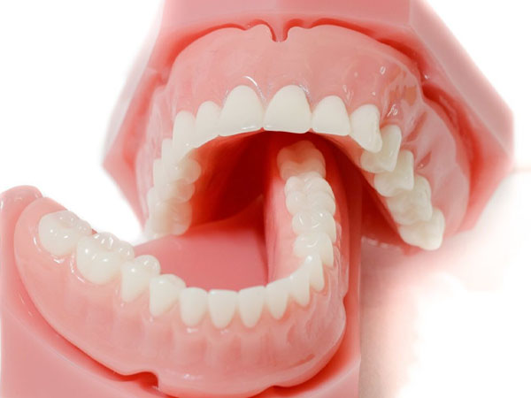 Răng sứ tháo lắp - Dòng răng tháo lắp cao cấp hiện nay 