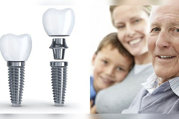 Vậy có thể trồng răng Implant cho người lớn tuổi không?