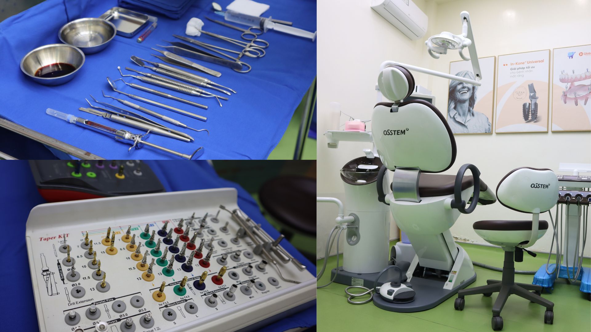 Trồng Răng Implant Trả Góp Lãi Suất 0% Tại Nha Khoa Sài Gòn St