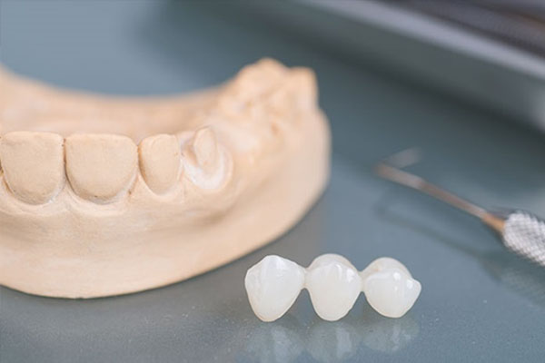 Phương pháp trồng răng sứ có đau không?