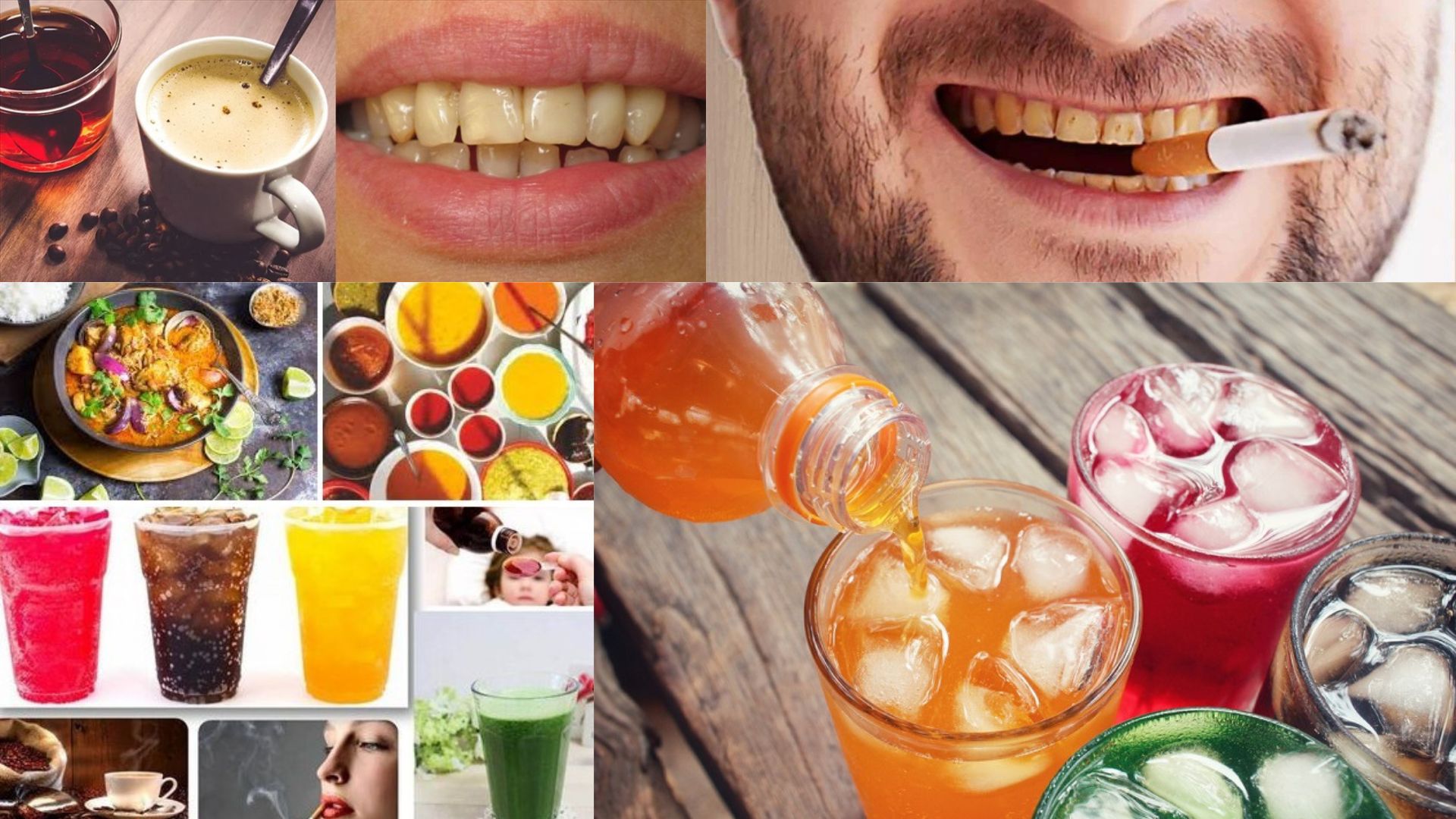 Hướng Dẫn Chăm Sóc Sau Khi Tẩy Trắng Răng