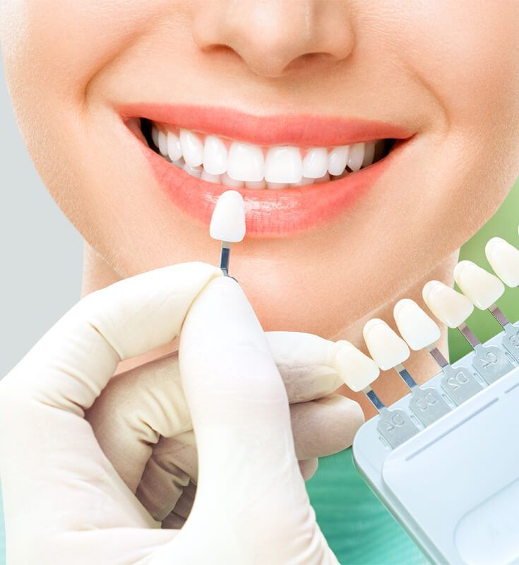 17 Tuổi Có Nên Bọc Răng Sứ Những Điều Cần Cân Nhắc Trước Khi Thực Hiện (4)