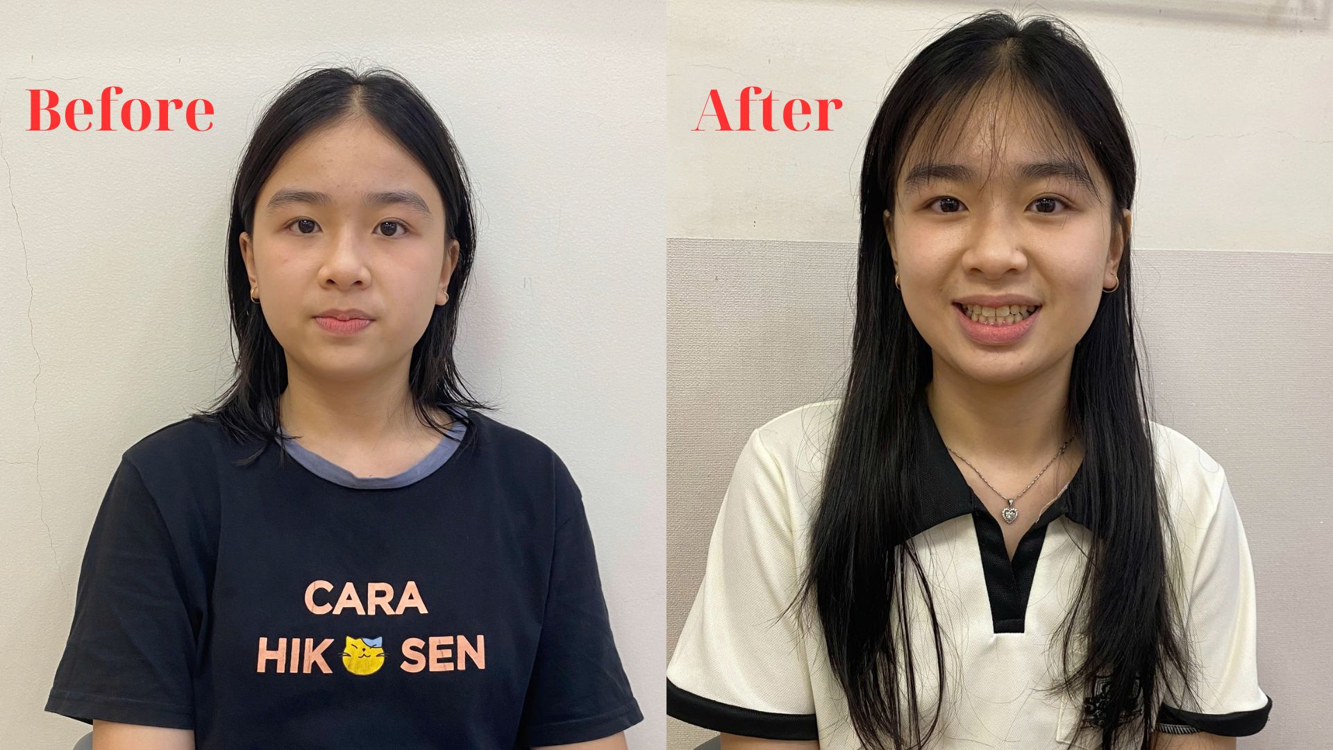 Chỉnh Nha Là Gì Các Phương Pháp Chỉnh Nha Hiện Nay