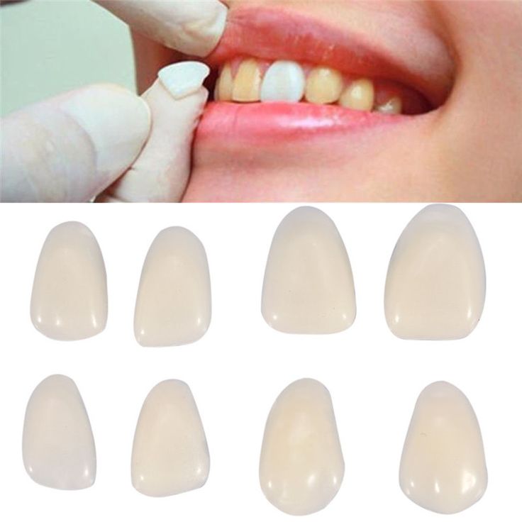 Hô Hàm Dưới Là Gì Nguyên Nhân Và Cách Điều Trị Hiệu Quả
