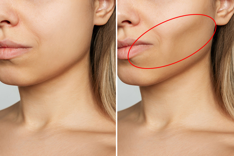Mất Răng Lâu Năm Liệu Có Khiến Bạn Già Đi Nhanh Hơn
